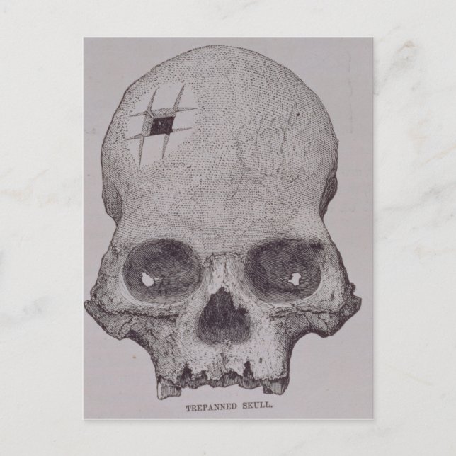 Trepanned Skull Postcard (Front)
