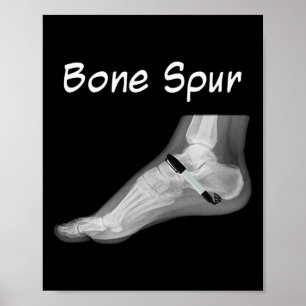 Trump Bone Spur Ink Pen Funny Anti Trump Poster