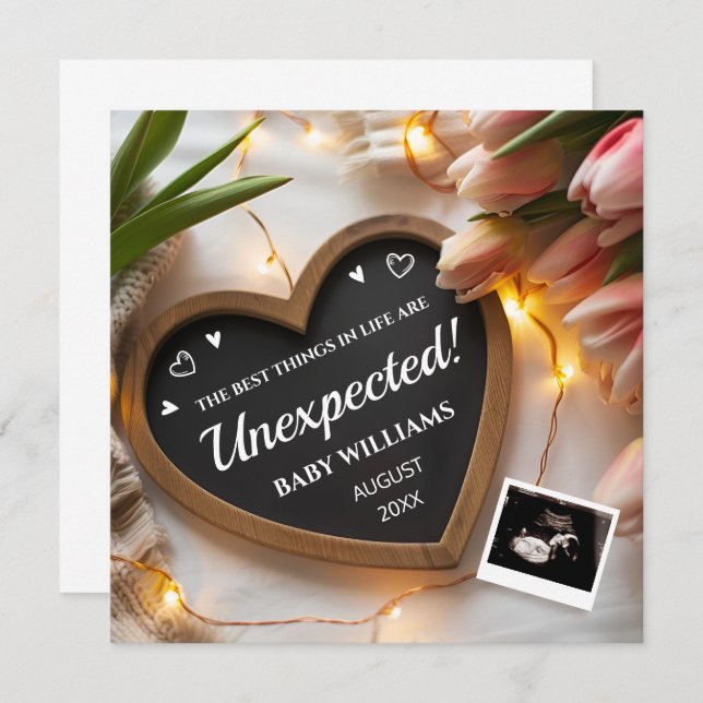 Tulips Baby Announcement Social Media (Front/Back)