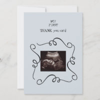 Ultrasons lunaires Merci Baby Point de vue