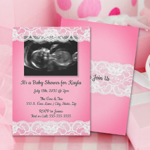 Ultrasound and Lace Baby Shower Invitation