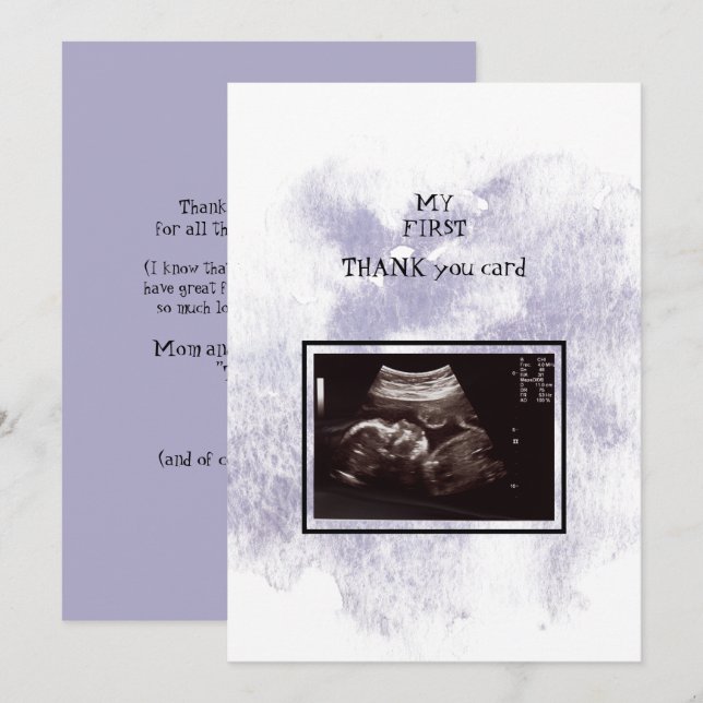 Ultrasound Girl Thank You Baby Point of View (Front/Back)