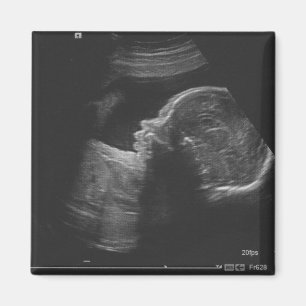 Ultrasound Magnet