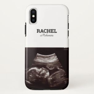 Ultrasound Photo Black and White Monogram Case-Mate iPhone Case
