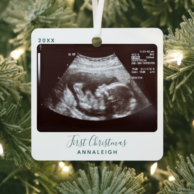 Ultrasound Photo First Christmas Sonogram Holiday Metal Ornament (Insitu)