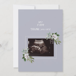 Ultrasound Photo Girl Merci Baby Point de vue