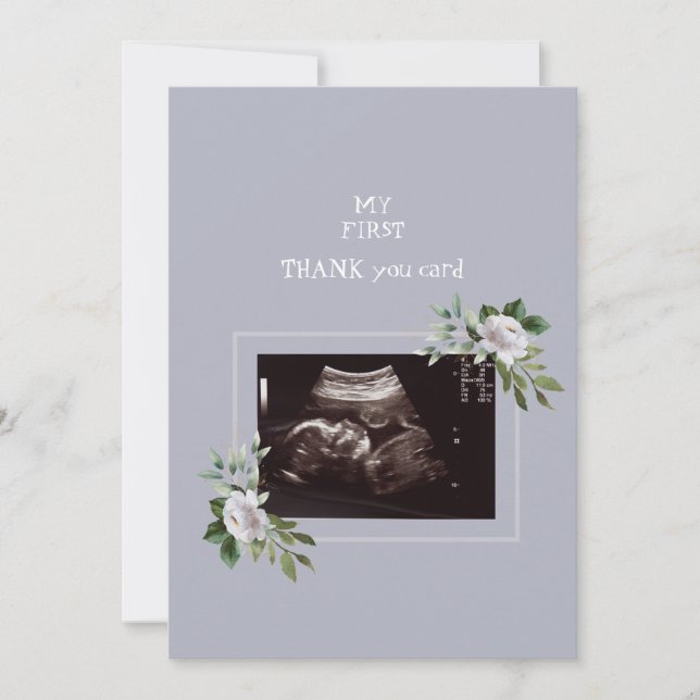 Ultrasound Photo Girl Thank You Baby Point of View (Front)