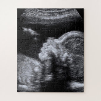 Ultrasound Photo Jigsaw Puzzle