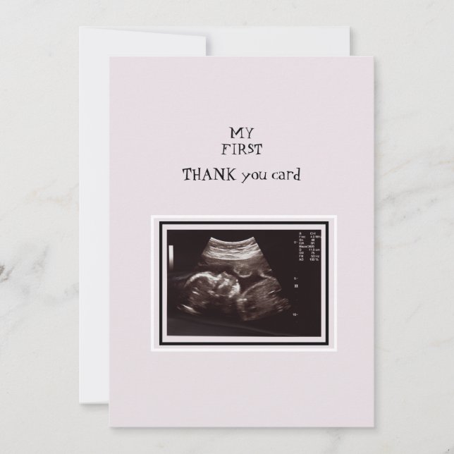 Ultrasound Photo Pink Thank You Baby (Front)