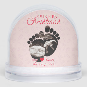Ultrasound Pregnancy Announcement 1st Christmas Snowglobe