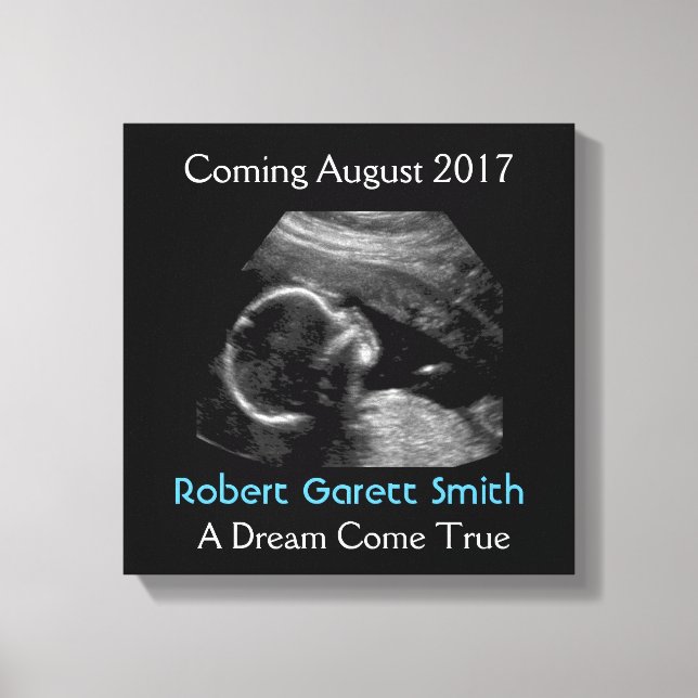Ultrasound with Name & Picture Canvas Wall Hanging (Front)