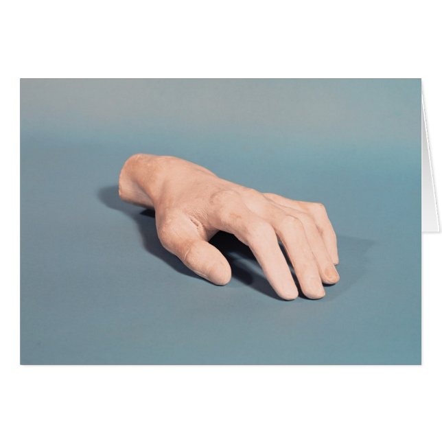 Un moulage de la main de Frédéric Chopin (Devant horizontal)