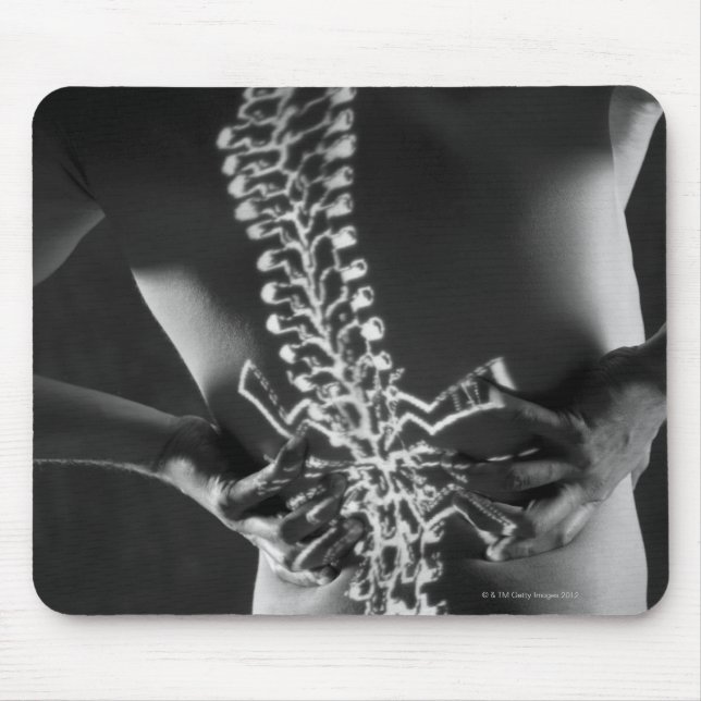 View of spinal chord mouse pad (Front)