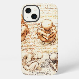 Views of a Fetus in the Womb,Ob-Gyn Medical iPhone 13 Case