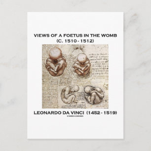 Views Of A Foetus In The Womb (Leonardo da Vinci) Postcard