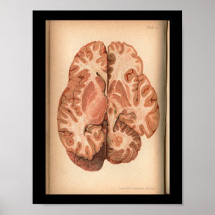 Vintage 1901 Brain Anatomy Print