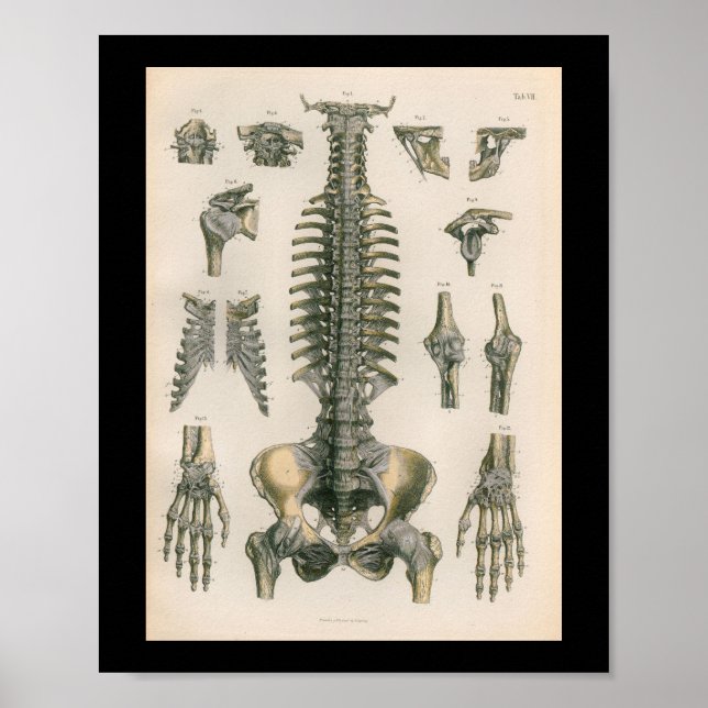 Vintage Anatomy Print Spine Spinal Bones (Front)