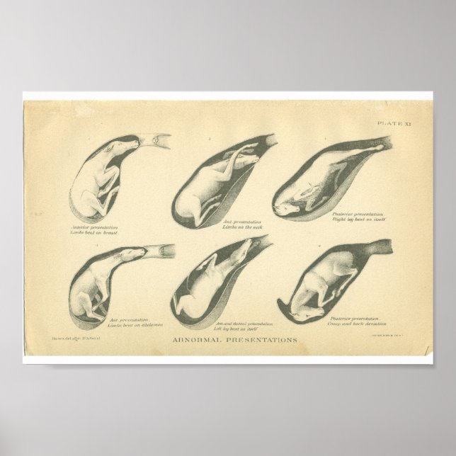 Vintage Horse Anatomy Print Foal Presentation (Front)