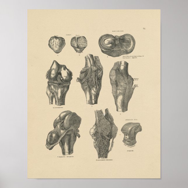 Vintage Knee Joint Anatomy 1880 Print (Front)