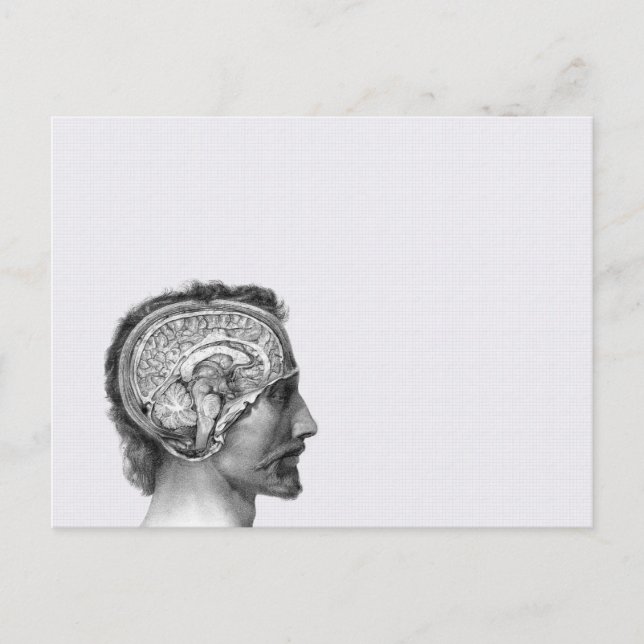 Vintage Medical Illustration Postcard (Front)