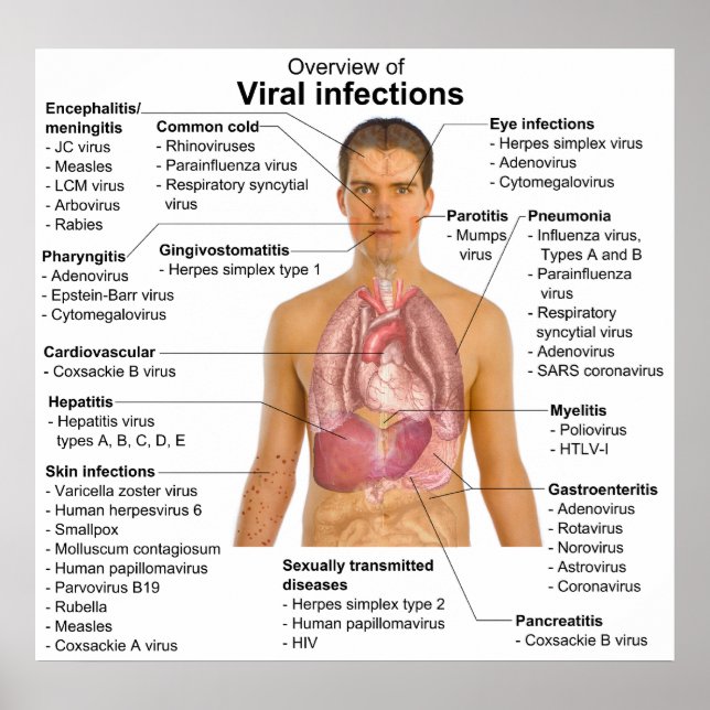 Viral Infections and the Species Involved Chart (Front)