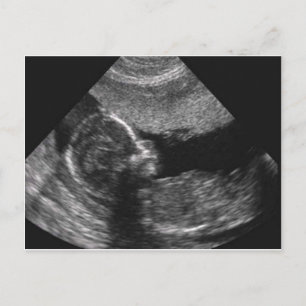 visage de bébé, carte