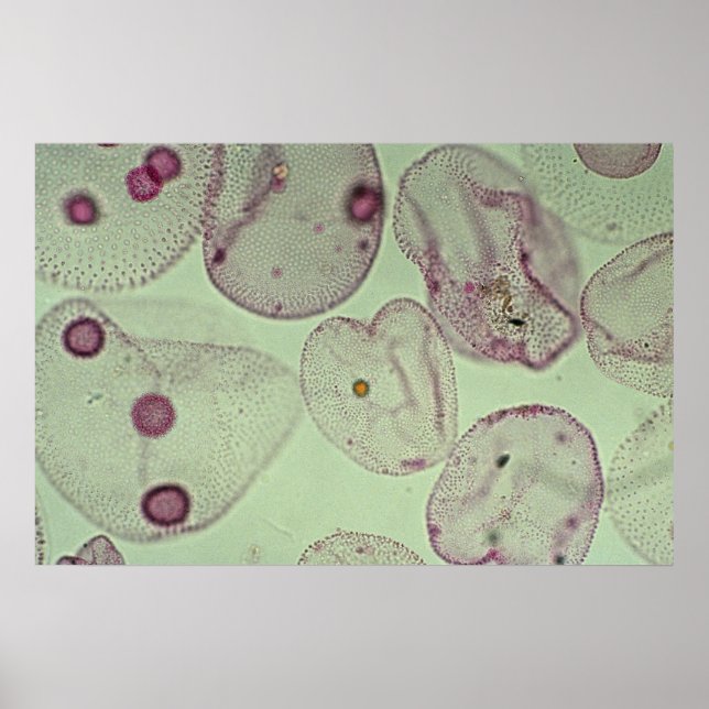 Volvox, algae poster (Front)