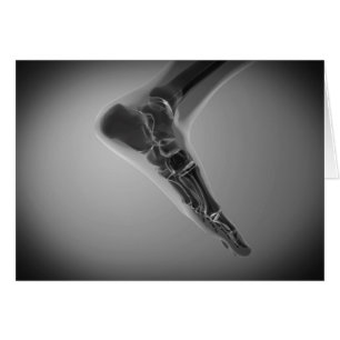 Vue En Rayon X Du Pied Humain 4