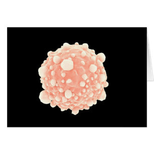 Vue microscopique de cellule cancéreuse