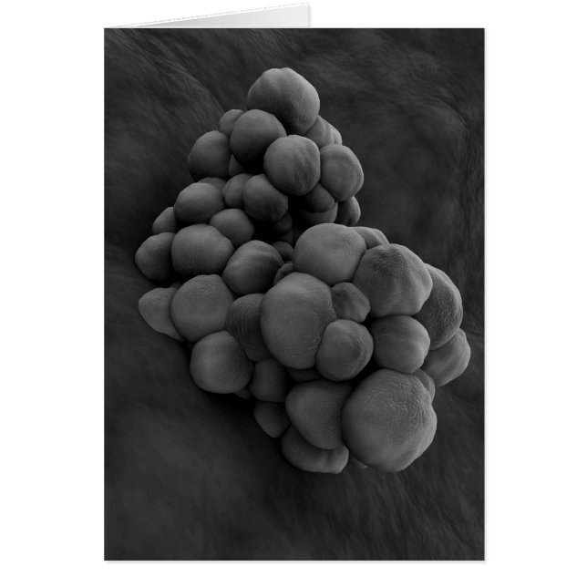 Vue Microscopique De La Tumeur 1 (Devant)