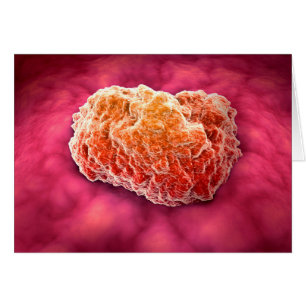 Vue Microscopique De La Tumeur 3