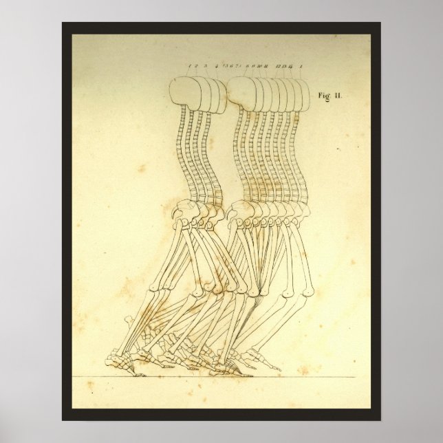 Walking Gait Analysis Leg Spine Chiropractic Chart (Front)