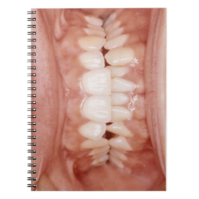 Weird Unusual Gory Teeth Gums Photo Notebook (Front)
