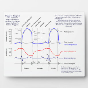 Wiggers Diagram Plaque