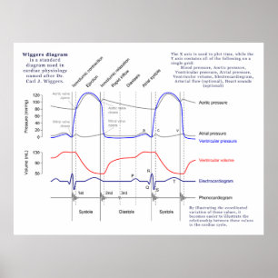 Wiggers Diagram Poster