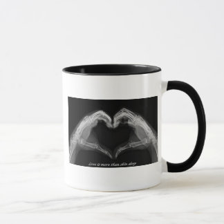 X-Ray Art Mug