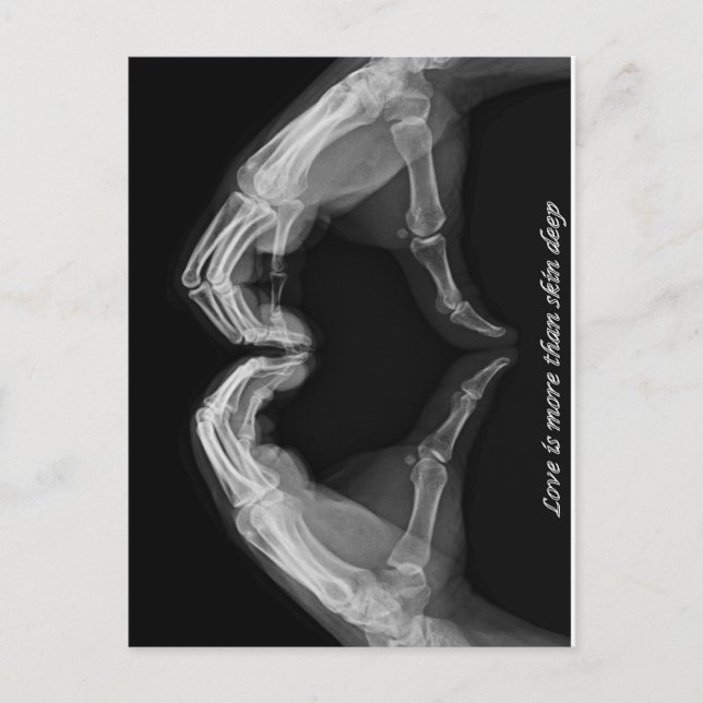 X-Ray Art Postcard (Front)