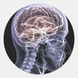 X-Ray Brain Classic Round Sticker
