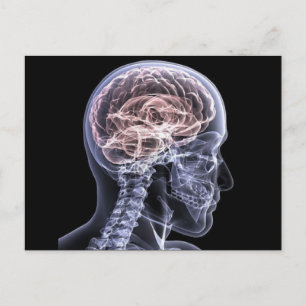 X-Ray Brain Postcard