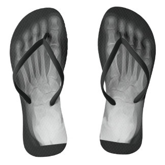 X-Ray Feet! Flip Flops