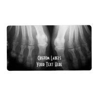 X-Ray Feet Human Skeleton Bones Black & White