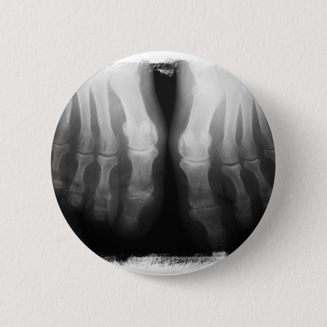 X-Ray Feet Human Skeleton Bones Black & White 2 Inch Round Button (Front)