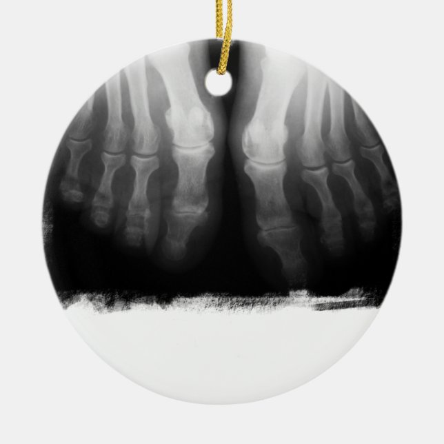 X-Ray Feet Human Skeleton Bones Black & White Ceramic Ornament (Front)