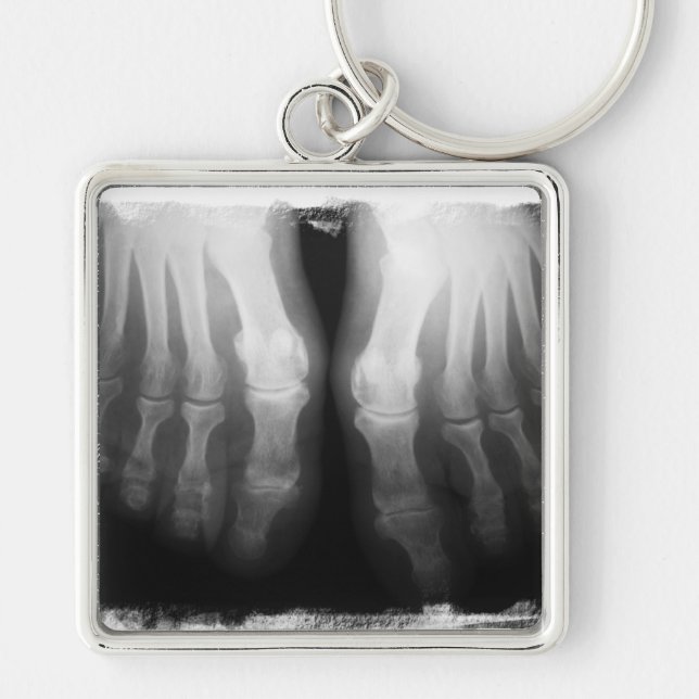 X-Ray Feet Human Skeleton Bones Black & White Keychain (Front)