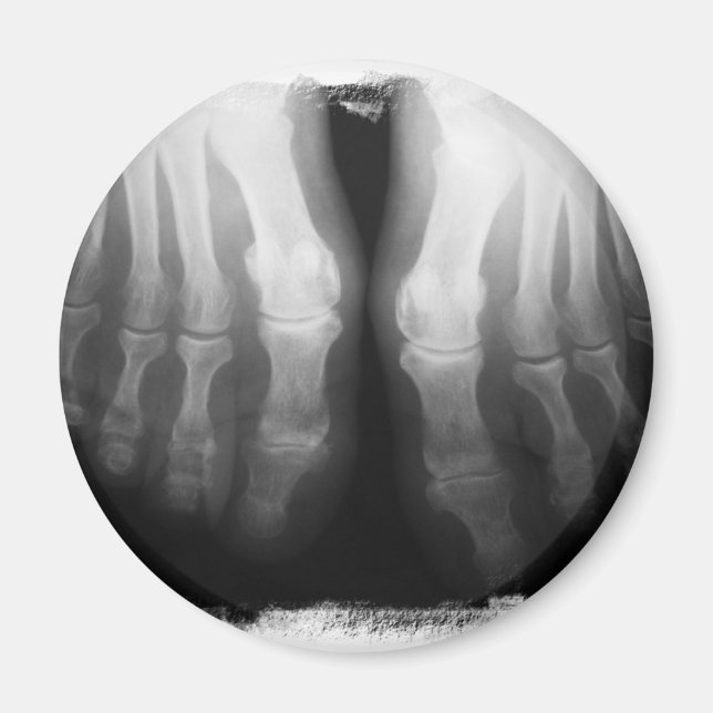 X-Ray Feet Human Skeleton Bones Black & White Magnet (Front)