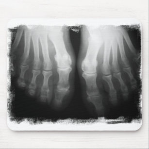 X-Ray Feet Human Skeleton Bones Black & White Mouse Pad