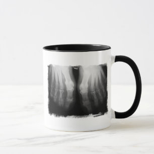 X-Ray Feet Human Skeleton Bones Black & White Mug