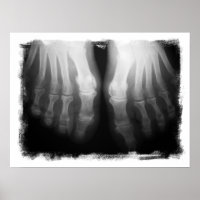 X-Ray Feet Human Skeleton Bones Black & White