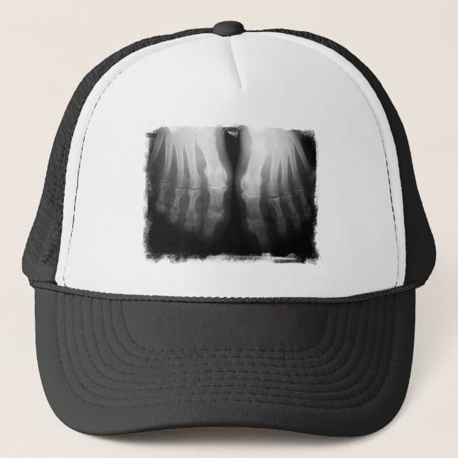 X-Ray Feet Human Skeleton Bones Black & White Trucker Hat (Front)