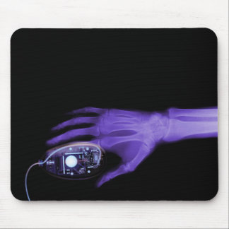X-Ray Hand & Computer Mouse Mouse Pad